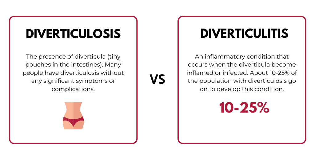 diverticulitis vs. diverticulosis